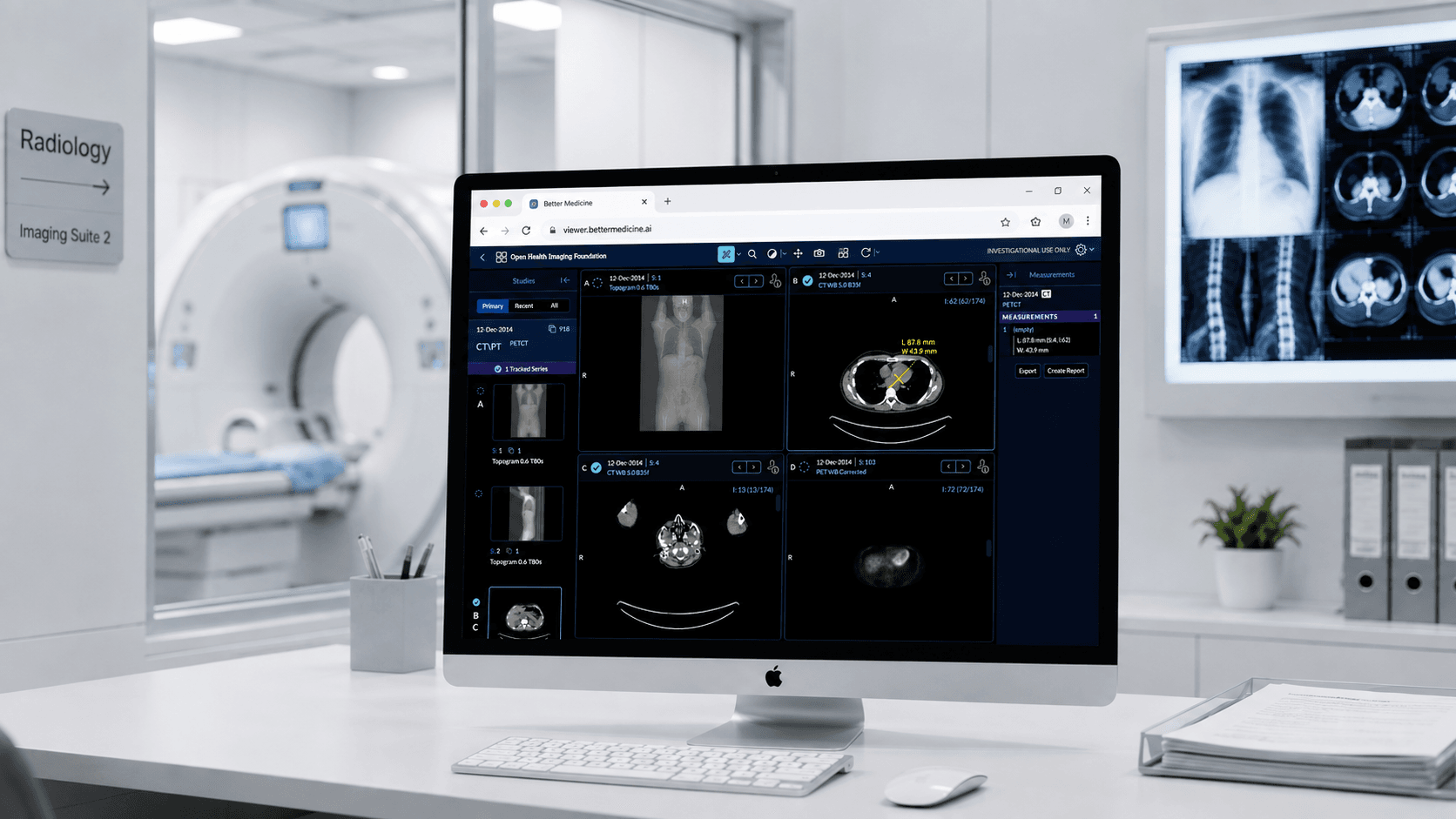 Better Medicine medical imaging viewer displayed on a desktop monitor in a radiology suite.